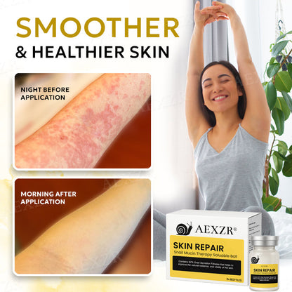 🌟 Official Store | AEXZR® Skin Repair Snail Mucin Therapy Soluble Ball🐌 – Heal Your Skin, Restore Your Confidence! AEXZR® Skin Repair Snail Mucin Therapy Soluable Ball✨
