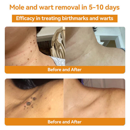 🌟 Last 14Pcs Left | Cvreoz® Bee Venom Skin Treatment Cream