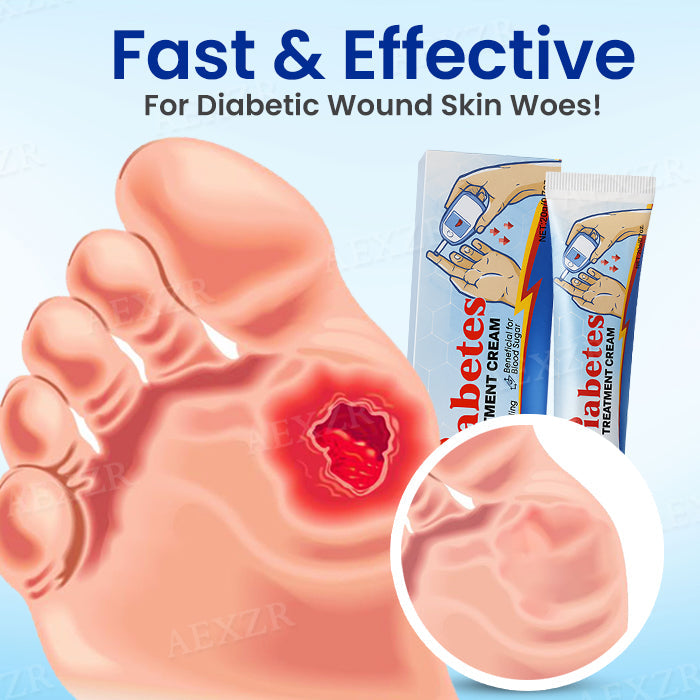 🌟 Official Store | Cvreoz® Diabetes Treatment Cream🔥 Reclaim Your Skin Health Today!