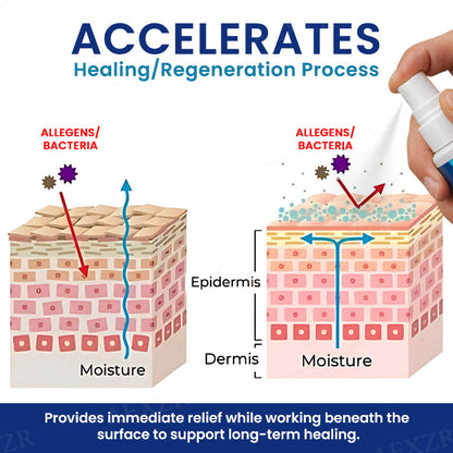 Best-Selling Product 2025🔥Cvreoz® Genital Treatment Spray - Already Helped 120,000+ Users Reclaim Their Comfort✅