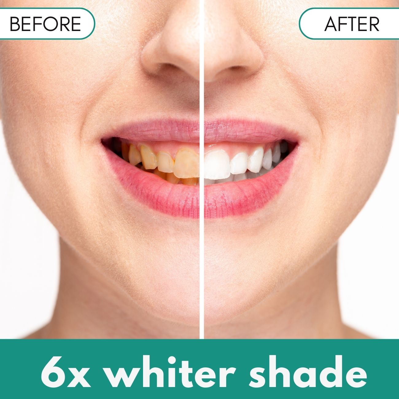 🌟 Official Store | Bikenda® Plaque & Stain Remover – Reveal Your Brightest Smile!✨