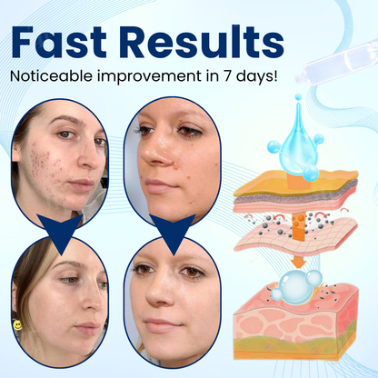 🌟 Best-Selling Product 2025🌟Unlock Flawless Skin with Cvreoz® Skin Radiant Care Drops! 🌟 Say Goodbye to Imperfections!