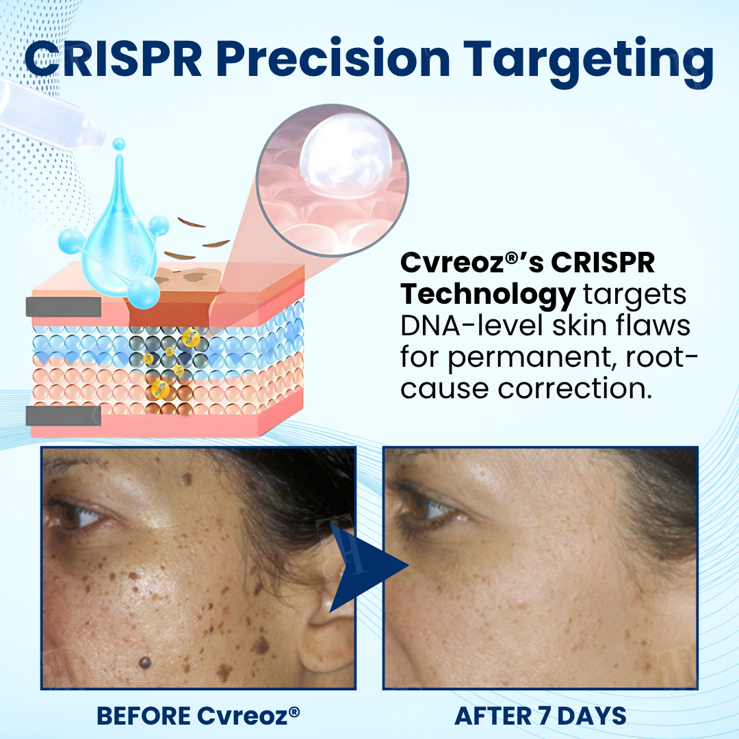 🌟 Best-Selling Product 2025🌟Unlock Flawless Skin with Cvreoz® Skin Radiant Care Drops! 🌟 Say Goodbye to Imperfections!