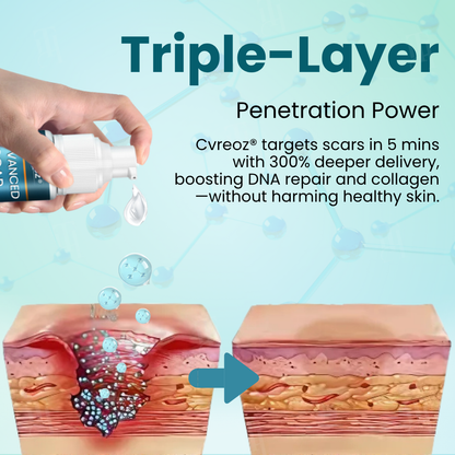 🌟 Official Store | Cvreoz® Advanced Scar Gel – Reveal Smooth, Healthier Skin Fast!✨