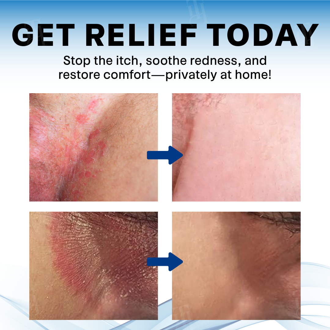 The FDA-Approved Solution🔥Croaie® Scrotum Itchy Treatment Cream - Already sold over 300,000 units worldwide✅