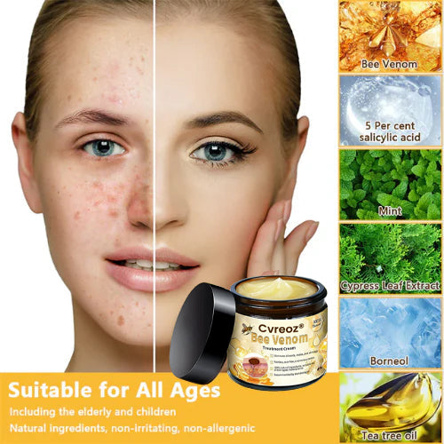 🌟 Last 14Pcs Left | Cvreoz® Bee Venom Skin Treatment Cream