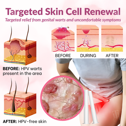 🌸 Official Store | Piguiay® Femina HPV Relief Gel – Your Gentle Solution to HPV Symptoms!💕