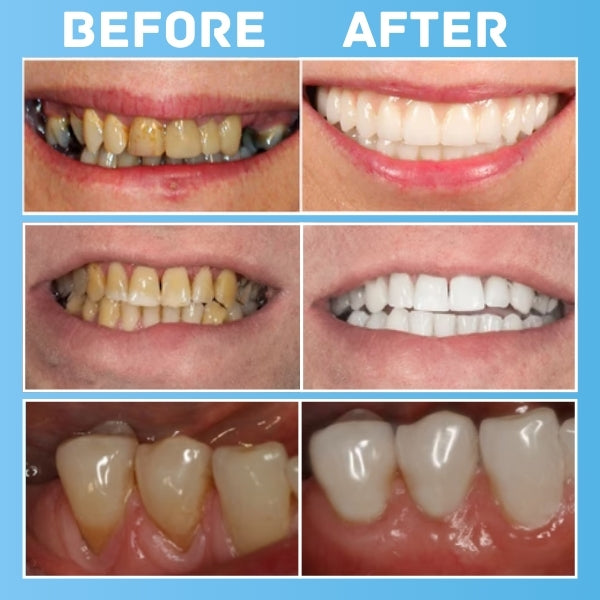 Cvreoz® All-in-1 Oral Cure Tablet - 👩‍⚕️ Recommended by Experts! 🔥 30-Days Money-Back Guarantee! 💰