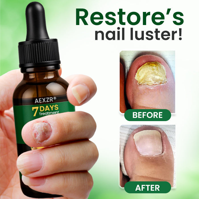🔥 Official Store | AEXZR® Fungal Nail Treatment✅ Say Goodbye to Fungal Infections and Hello to Healthy Nails!