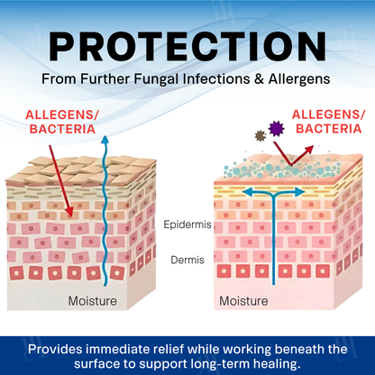 The FDA-Approved Solution🔥Croaie® Scrotum Itchy Treatment Cream - Already sold over 300,000 units worldwide✅