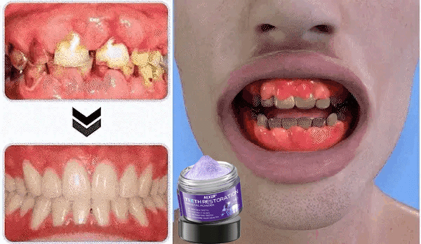 🌟 Official Store |🔥Hot Sale - 50% OFF🌿 AEXZR® Teeth Restoration Mineral Powder