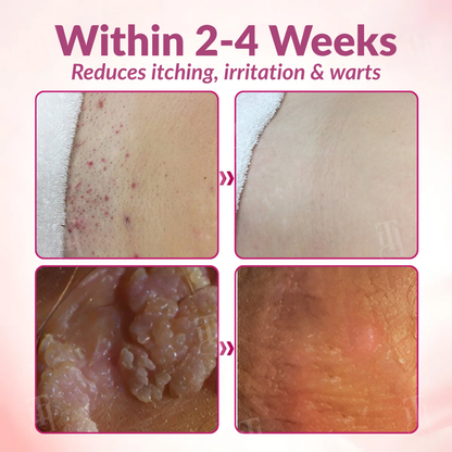 🌸 Official Store | Piguiay® Femina HPV Relief Gel – Your Gentle Solution to HPV Symptoms!💕