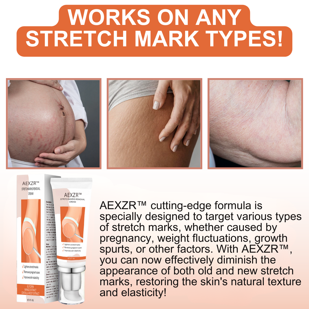 AEXZR™ Stretchmarks Removal Cream - Last day discounts 💲 up to 80% Off 🤑