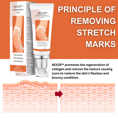 AEXZR™ Stretchmarks Removal Cream - Last day discounts 💲 up to 80% Off 🤑
