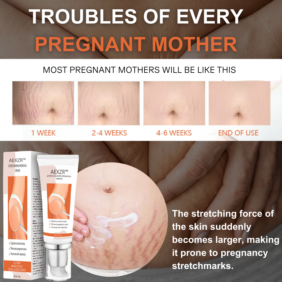 AEXZR™ Stretchmarks Removal Cream - Last day discounts 💲 up to 80% Off 🤑